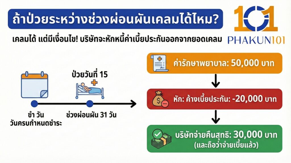 ถ้าป่วยระหว่างช่วงผ่อนผันเคลมได้ไหม